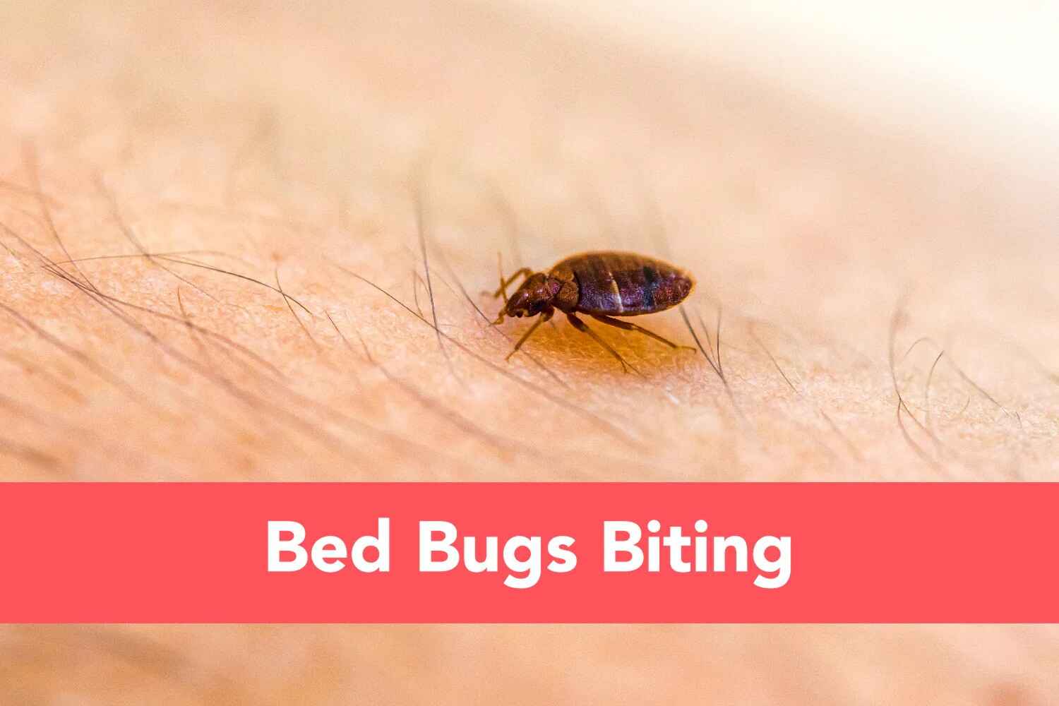 what-you-need-to-know-about-bed-bug-bites